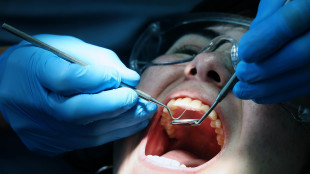 Nuovo gel 'bioispirato' rigenera lo smalto dei denti