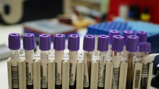 Ocho ni&ntilde;os muertos por un brote de leptospirosis en una comunidad ind&iacute;gena de Ecuador