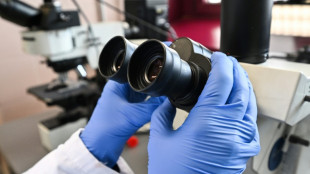 Evolution : le cloaque des poissons a donn&eacute; l'id&eacute;e &agrave; nos doigts de pousser