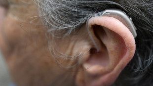 BGH verhandelt über Werbung mit Payback-Punkten beim Kauf von Hörgeräten