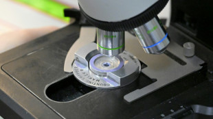 Des chercheurs confirment l'existence de la supersolidit&eacute;