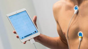 Malattie del cuore, al Sud meno cure e pi&ugrave; anni di vita persi