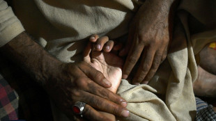 Novo dispositivo ajuda tetrapl&eacute;gicos a recuperar movimentos de bra&ccedil;os e m&atilde;os