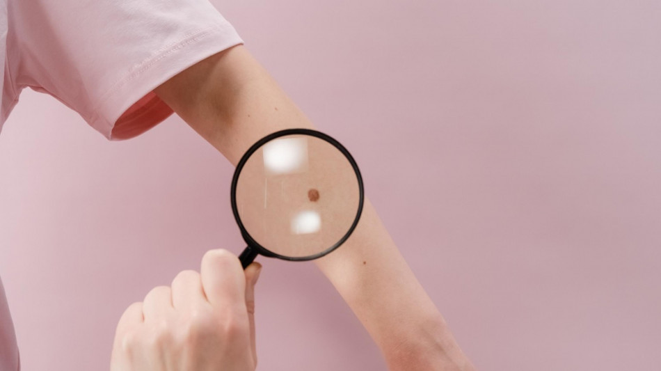 Dermatologi, 'no alla mappatura nei ai medici medicina generale'