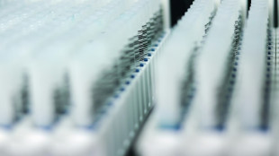 Endom&eacute;triose: un test salivaire "prometteur" devrait bient&ocirc;t &ecirc;tre disponible