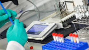 Ricerca Trieste-Londra per capire morte improvvisa giovanile