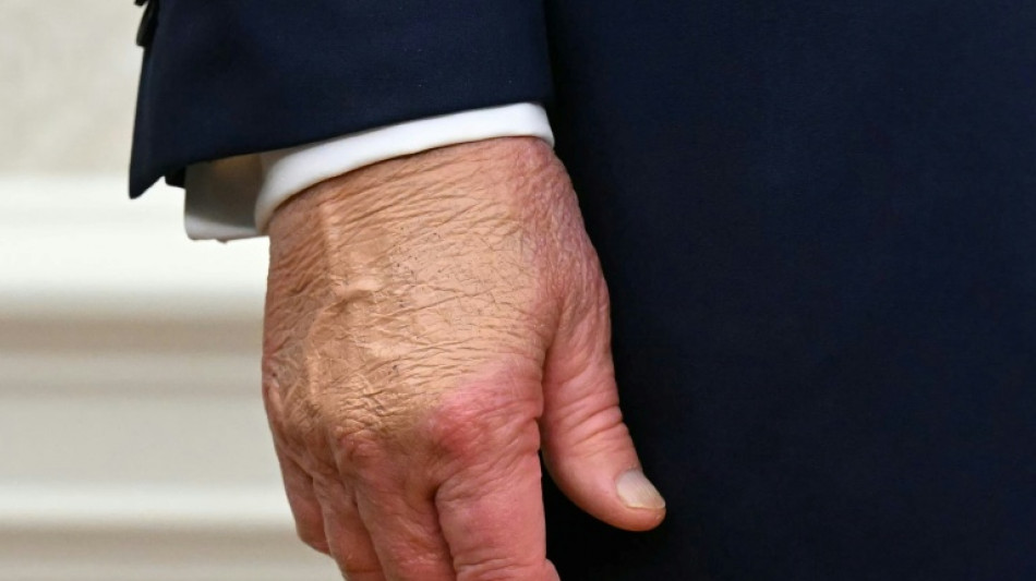 Trump atribuye a la aspirina los moretones en sus manos y niega dormirse en p&uacute;blico